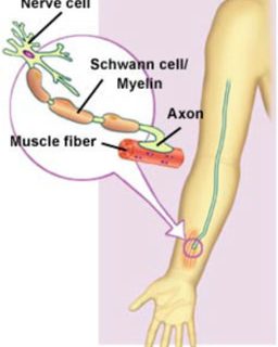 Charcot Marie 01