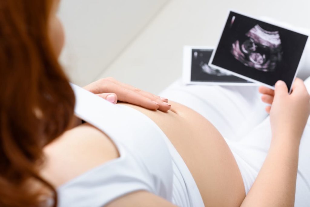 la diagnosi prenatale per distrofia muscolare ereditaria