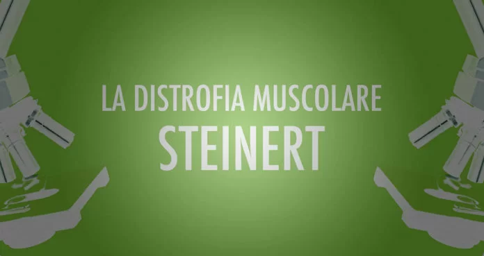 Distrofia Muscolare Steinert