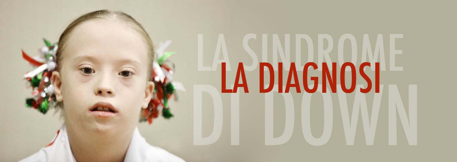 diagnosi sindrome di down