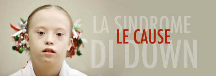sindrome di down cause