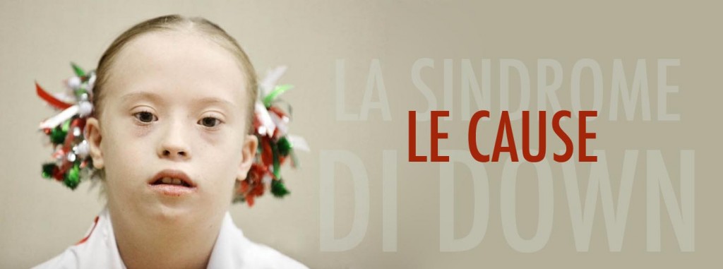 Le cause della sindrome di down