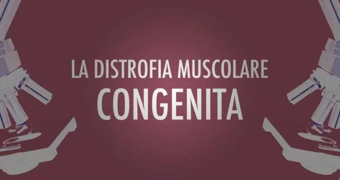 Distrofia muscolare congenita