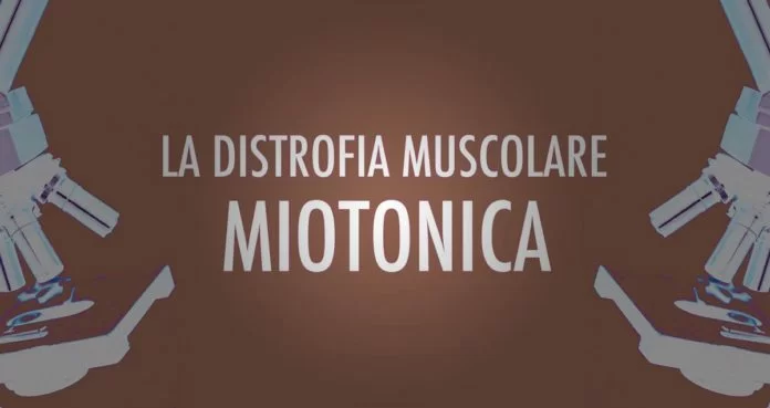 Distrofia muscolare miotonica