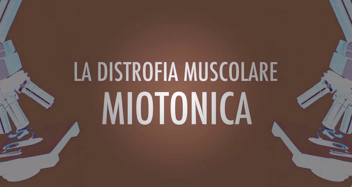 Distrofia muscolare miotonica 