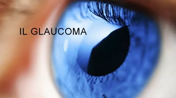 glaucoma