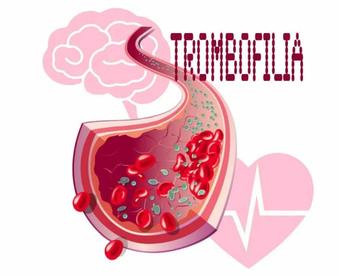 Trombofilia