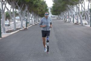sindrome dell'arto fantasma