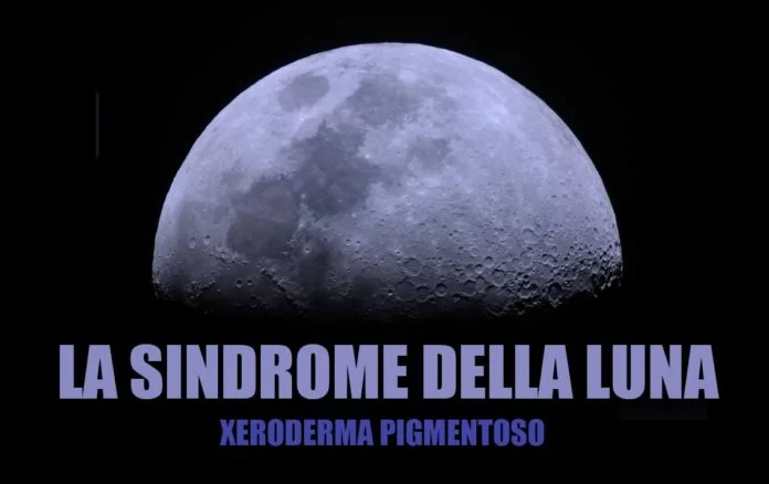 sindrome-della-luna-01