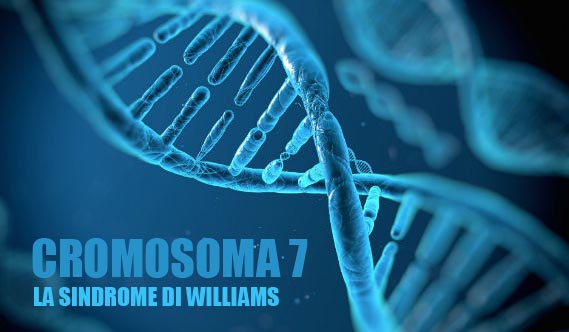 sindrome-di-williams-02