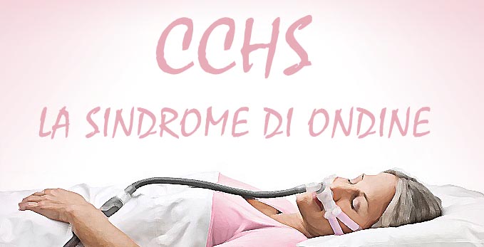 Sindrome di ondine