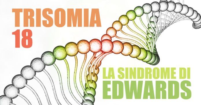 Trisomia 18