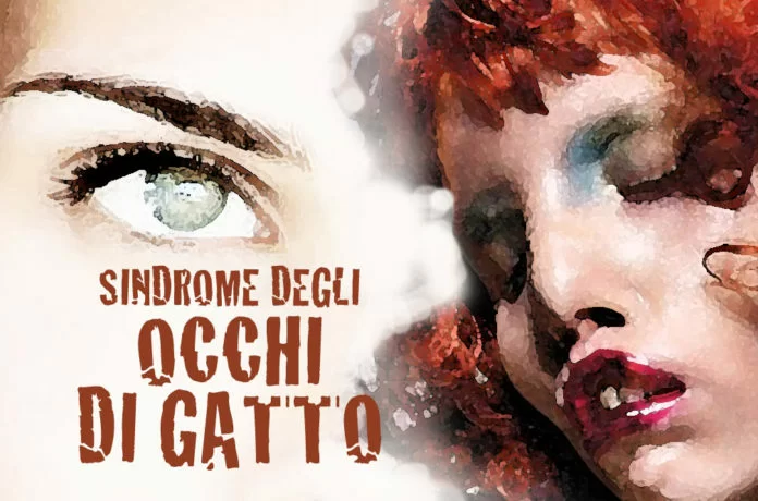 Sindrome degli occhi di gatto 02