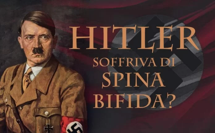 Hitler spina bifida