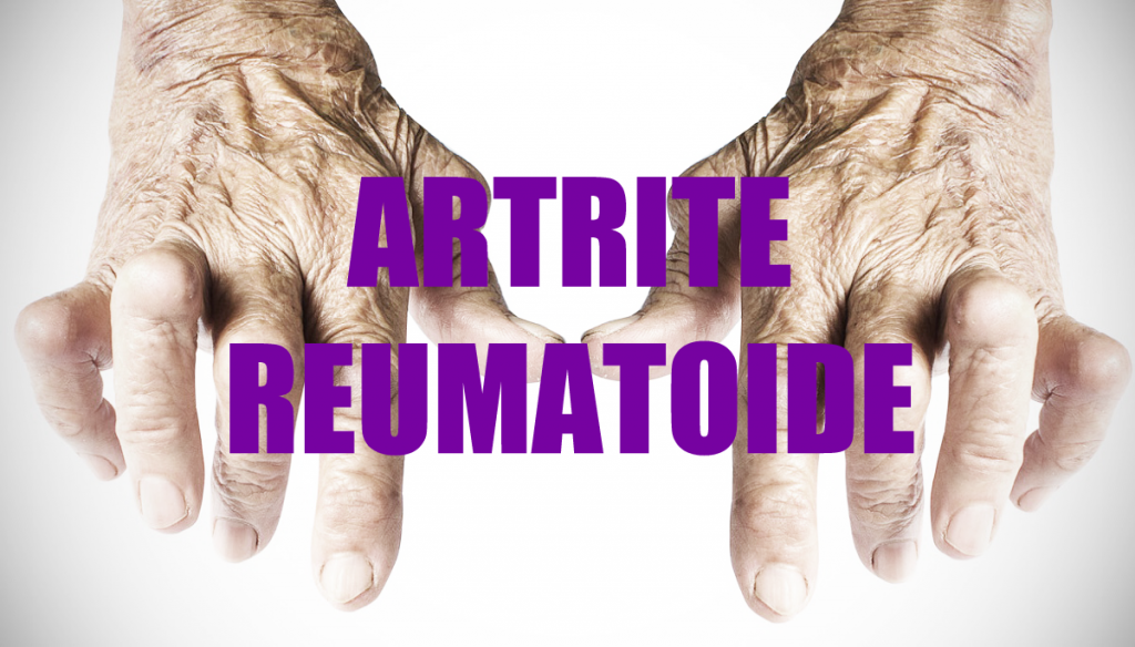 dieta per migliorare lartrite reumatoide