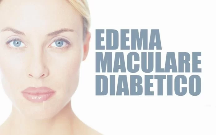 Edema maculare diabetico