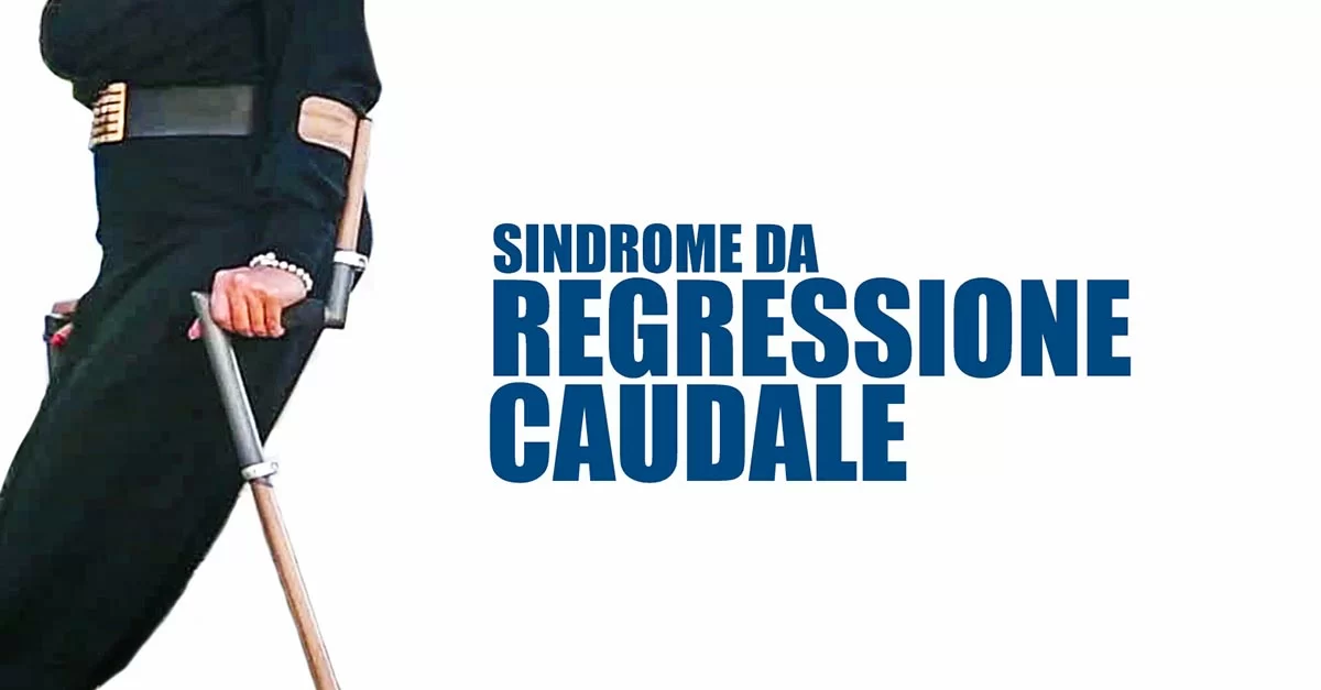 Sindrome regressione caudale