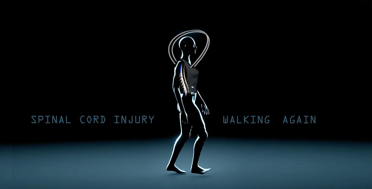 stimo paraplegia