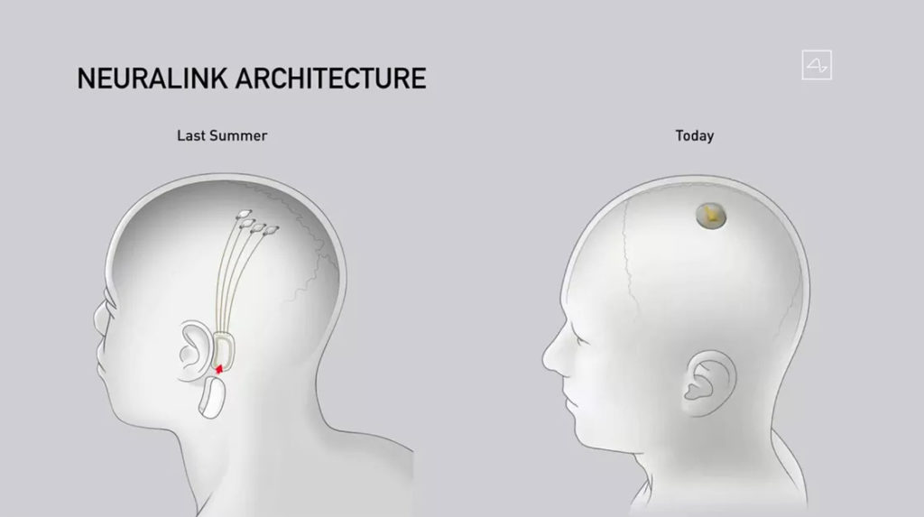 dispositivo neuralink di elon musk