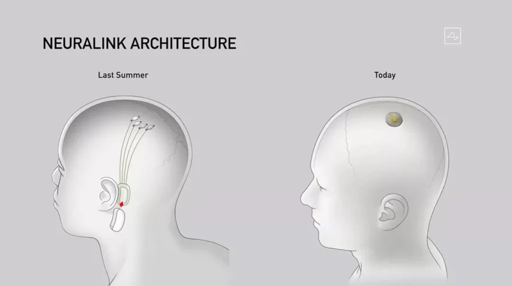 dispositivo neuralink di elon musk