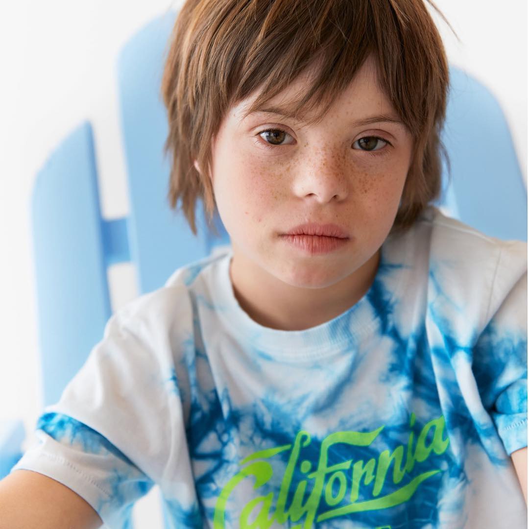 modello con la sindrome di down-patrick modello con la sindrome di down-patrick zara sindrome di down-ability channel-modello zara con la sindrome di down-testimonial zara con la sindrome di down
