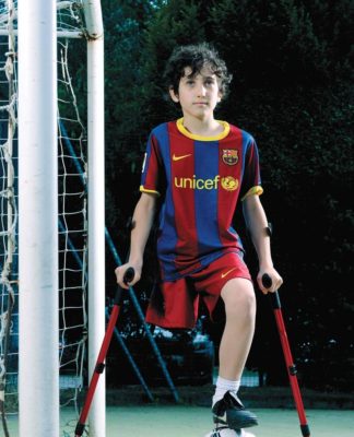 calcio-amputati-11