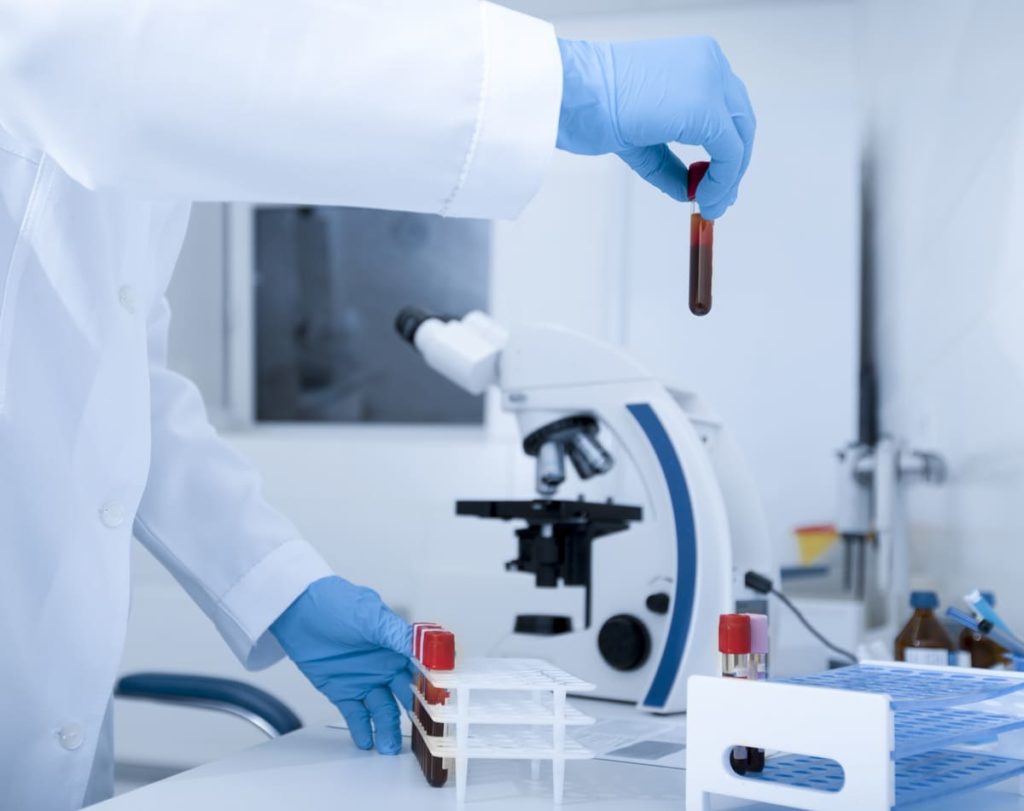 ricerca cause sideremia