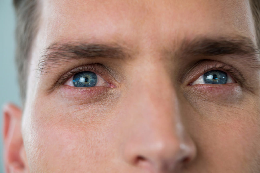 sintomi della miopatia oculare