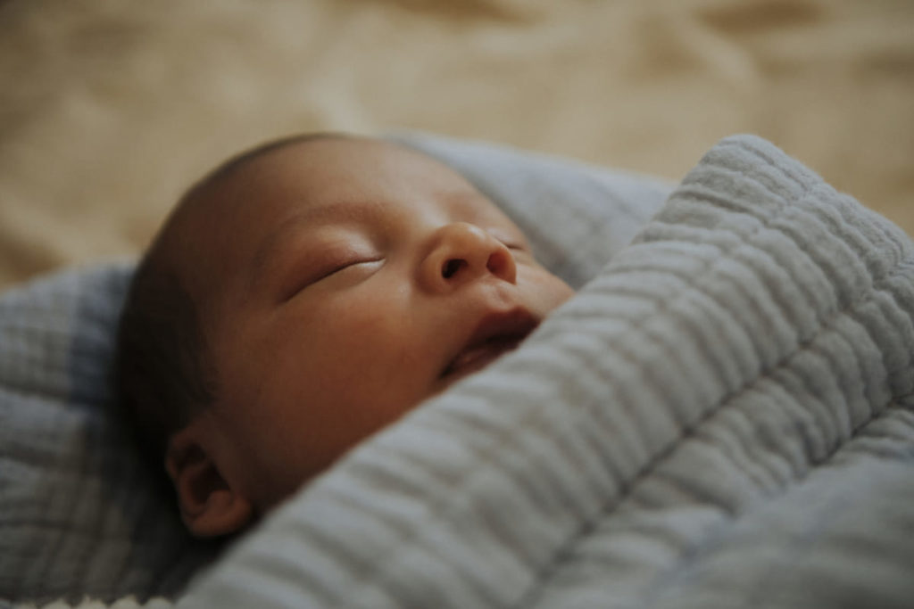 neonato con anemia neonatale