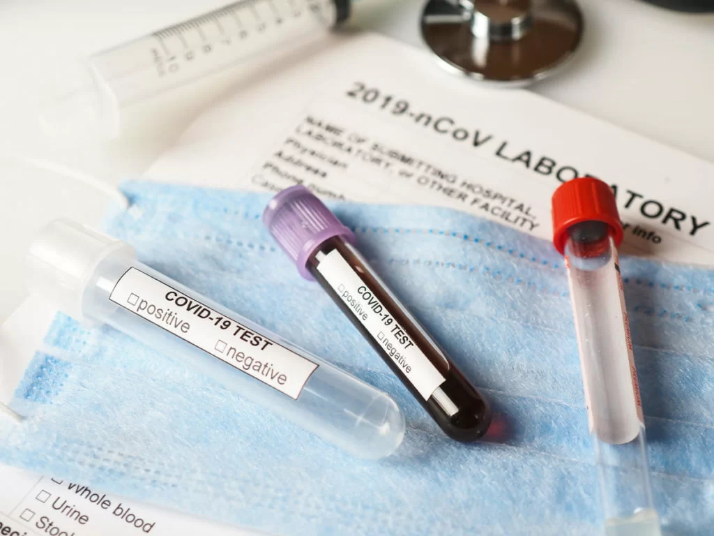 test coronavirus test sierologico