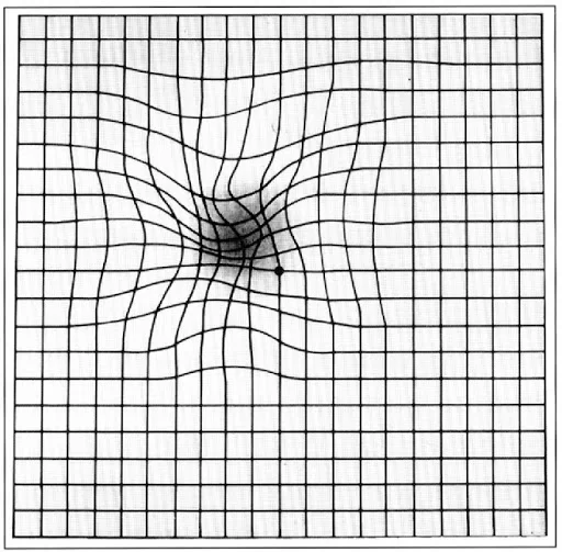 griglia o test di amsler