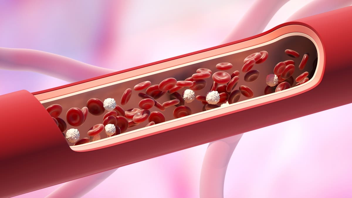 Angiosclerosi: cos'è, sintomi, rimedi e come si cura