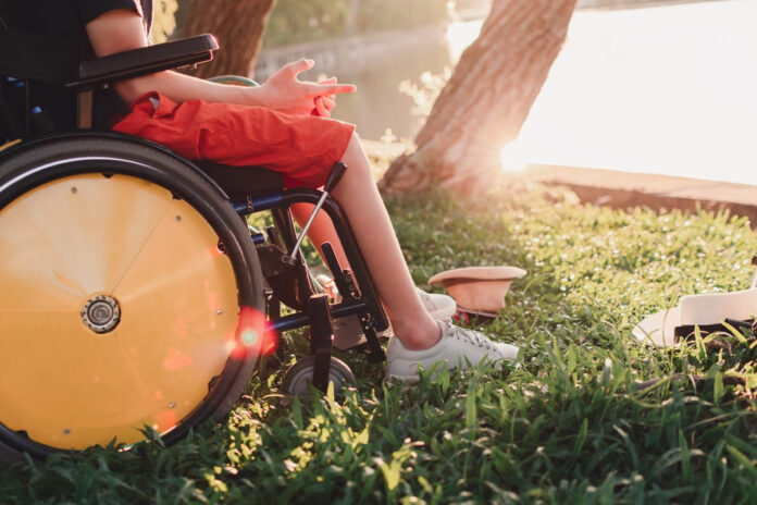 distrofia miotonica di steinert